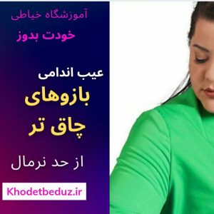 عيب اندامي بازوهاي چاق